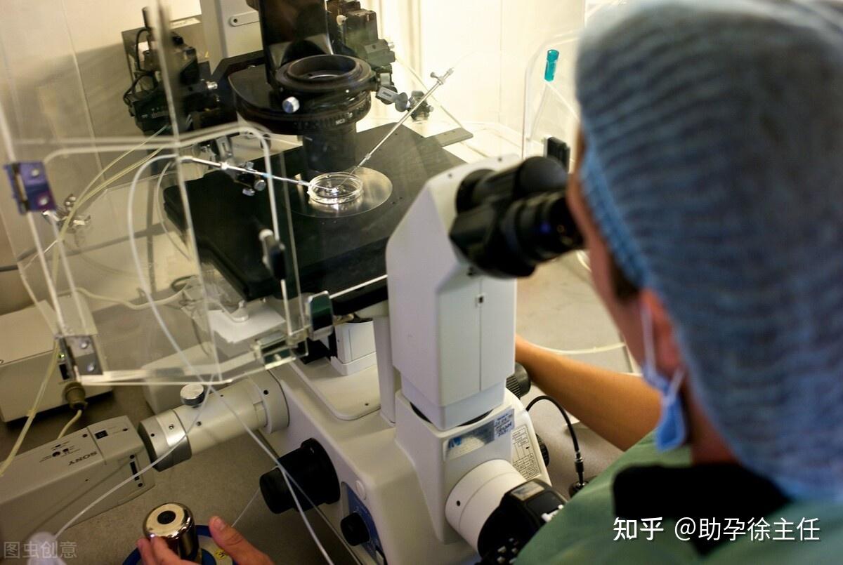 b超最少多少天能看到孕囊 b超最短几天能查出孕囊